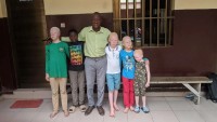 Le papa des albinos en visite